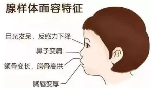 孩子睡覺打鼾、張口呼吸,小心會讓孩子“變丑變笨”!